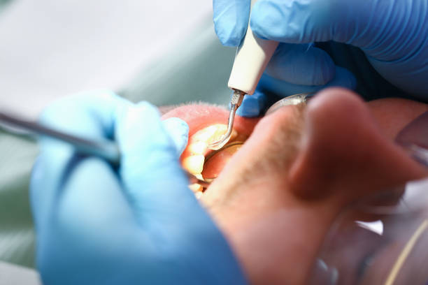 Best Emergency Dental Services for Seniors in Thurmont, MD