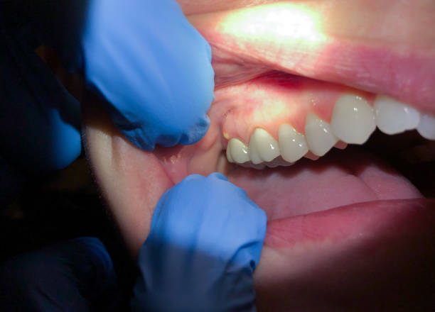 Best Pediatric Emergency Dentist in Thurmont, MD